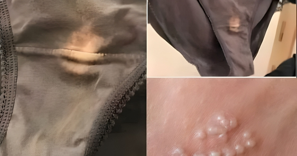 Noticed a “Bleach” Patch on Your Underwear? You better know what it ...