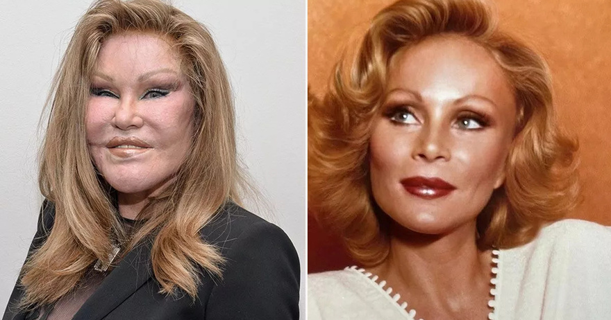 Jocelyne Wildenstein claims she ‘never had plastic surgery’ despite shocking ‘Catwoman’ face
