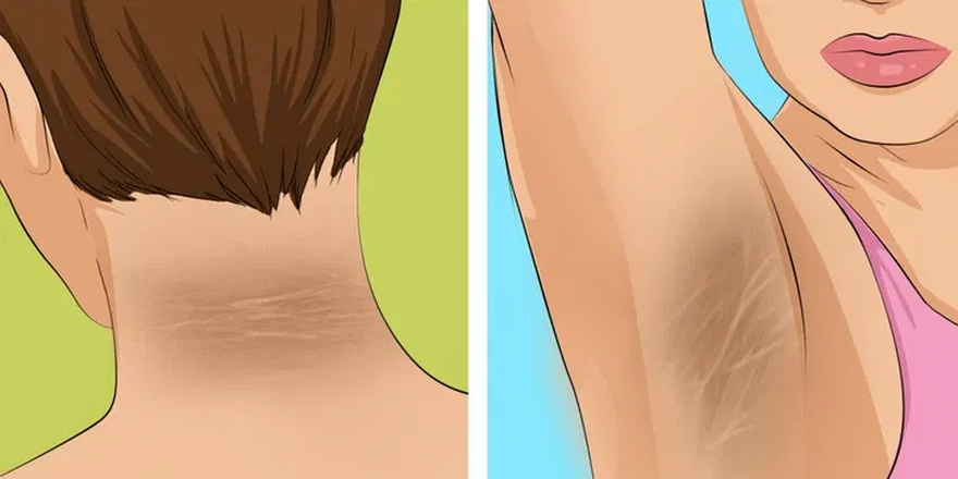 9 Wa:rning Signs of Diabetes You Might Be Overlooking