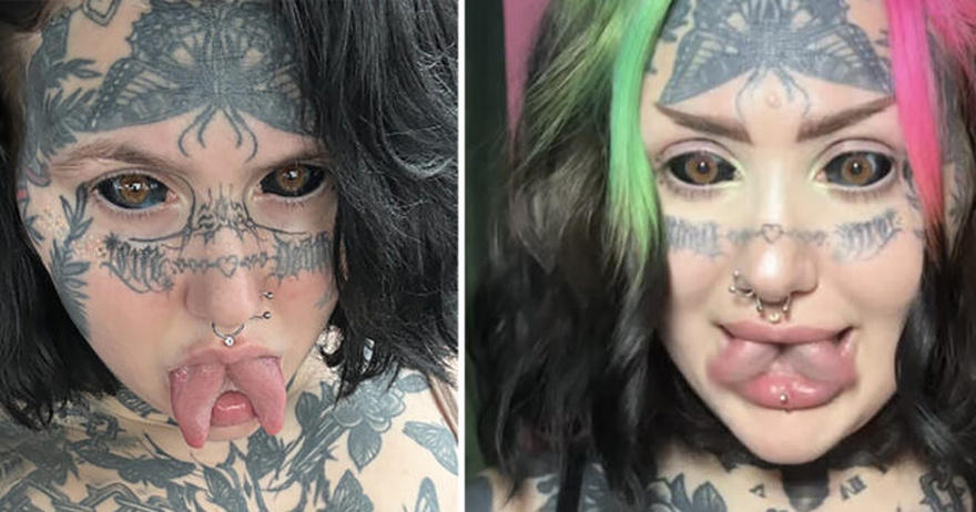Orylan spent $70K on extreme makeover – shocks with before photos