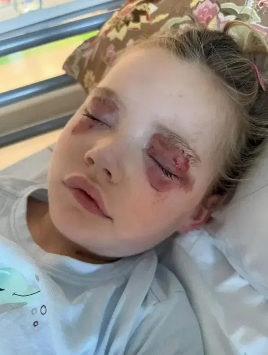 Urgent war.ning after girl is blinded from household product