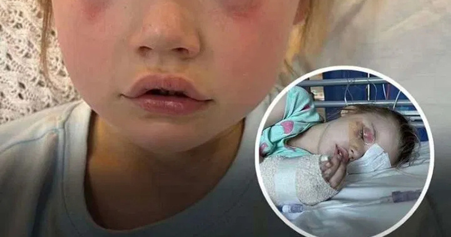 Urgent war.ning after girl is blinded from household product