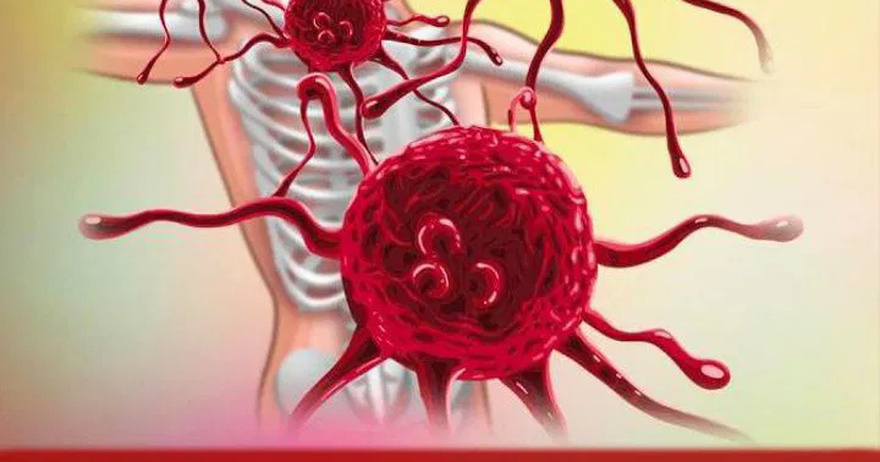 10 Foods That Prevent and Fight Can.cer