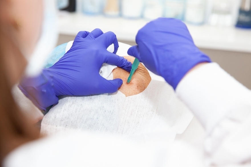 How To Reduce Age Spots: Causes, Treatment, and Prevention