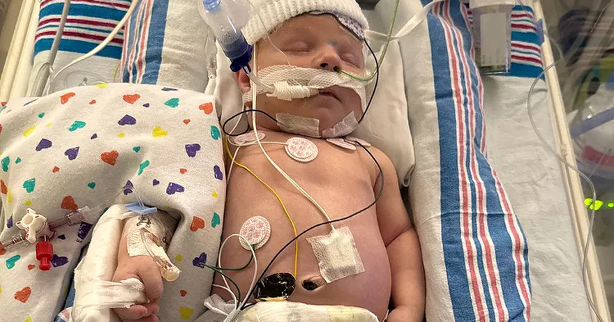 Parents Claim Newborn ‘Nearly Bled to Death’ After Circumcision, Is in Critical Condition: ‘We Are Living a Nightmare’