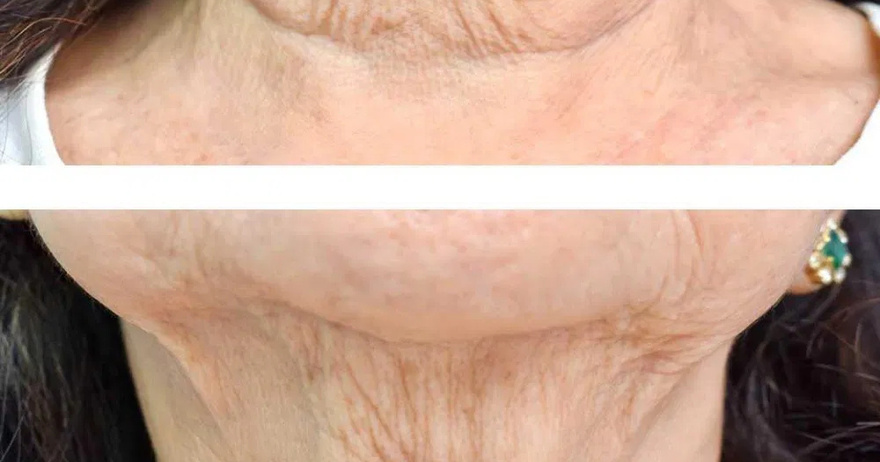 My nana swears by applying baking soda to her face. Here’s her 3 methods and how they work