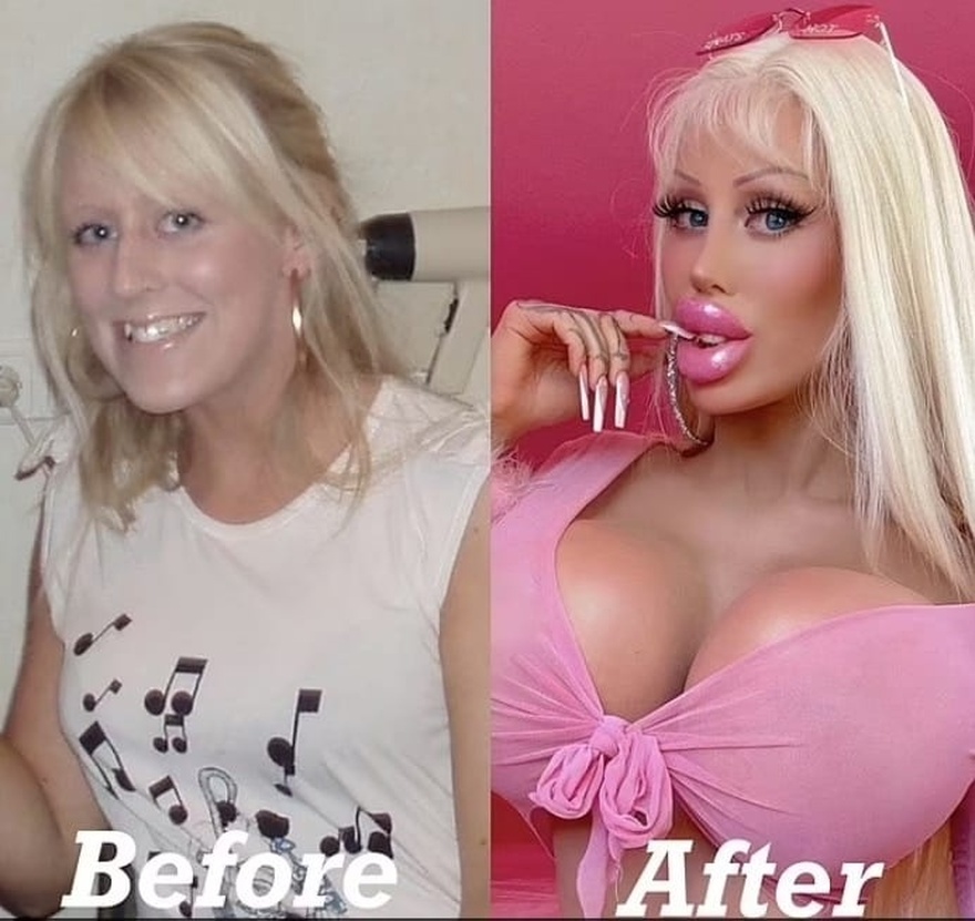 Swedish ‘Barbie’ spent over $120k on her body, reveals what she looked like before