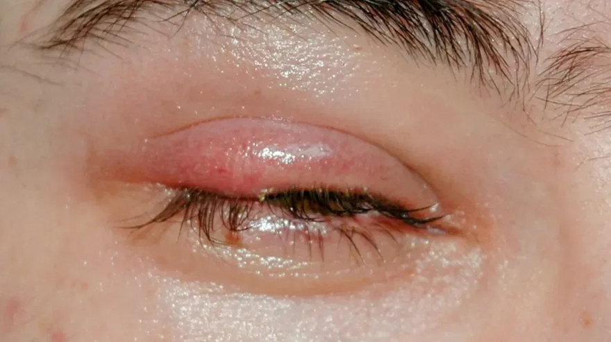 If you see this in your EYES, be careful it means…