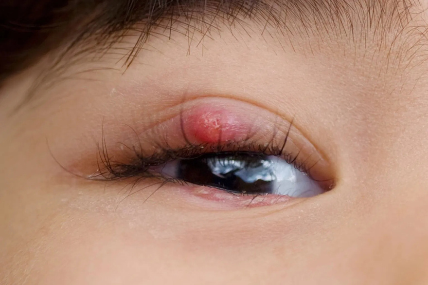 If you see this in your EYES, be careful it means…