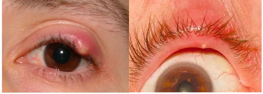 If you see this in your EYES, be careful it means…