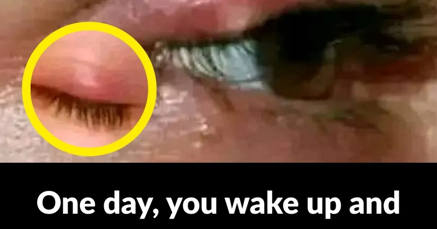 If you see this in your EYES, be careful it means…