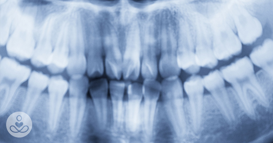 The Cause of Alzheimer’s Could Be Coming From Inside Your Mouth, Study Claims