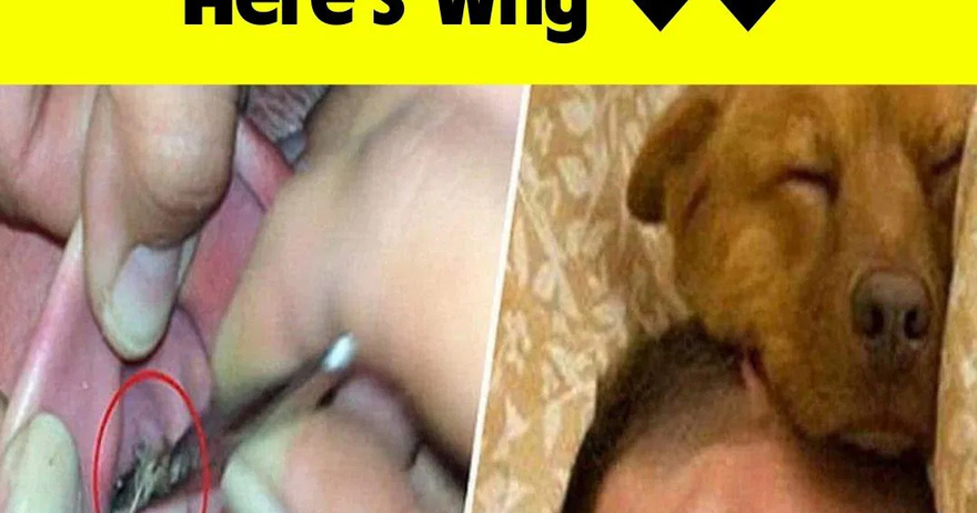 Don’t sleep with your pets, don’t risk your life, here’s why