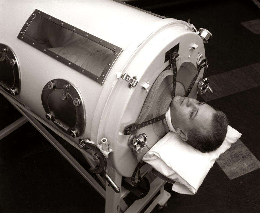 76-year-old man, paralyzed from polio at 6, was one of the last people with an iron lung: ‘My life is incredible’
