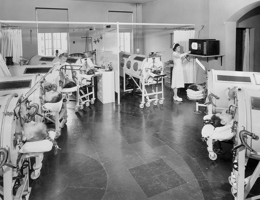 76-year-old man, paralyzed from polio at 6, was one of the last people with an iron lung: ‘My life is incredible’