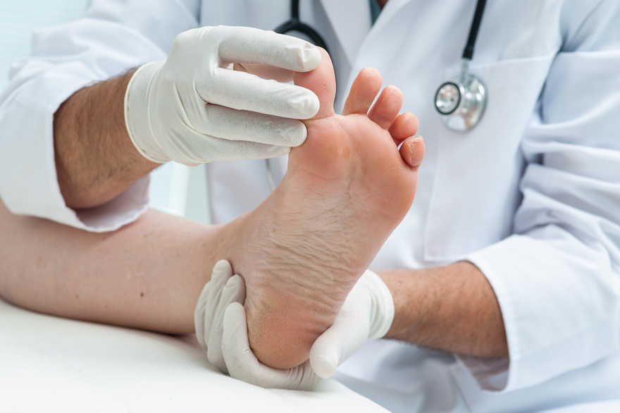10 Symptoms of Diabetes That May Show Up In Your Feet