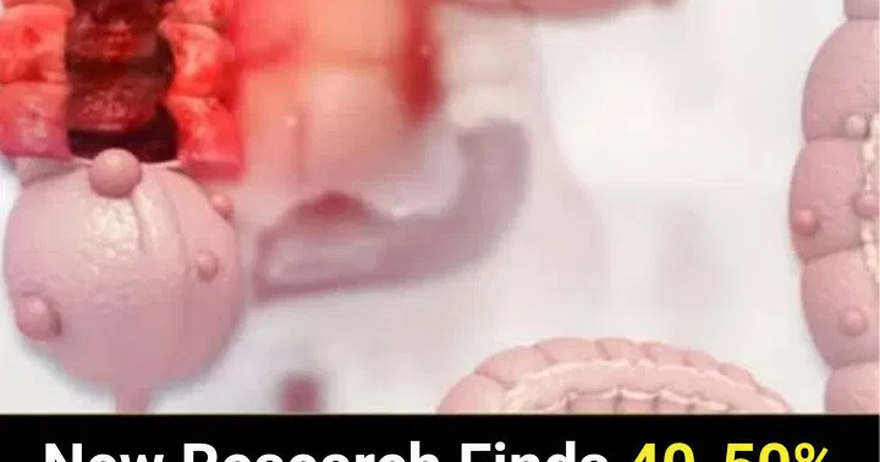 New Research Finds 40-50% of Colon Can.cer Cases Can Be Prevented by Doing These Simple Things