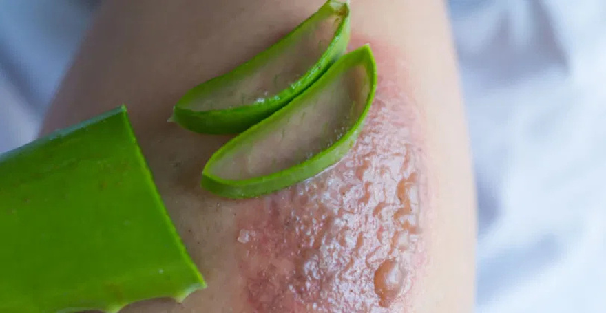 If You See These Painful Red Bumps, Here’s What It Really Means