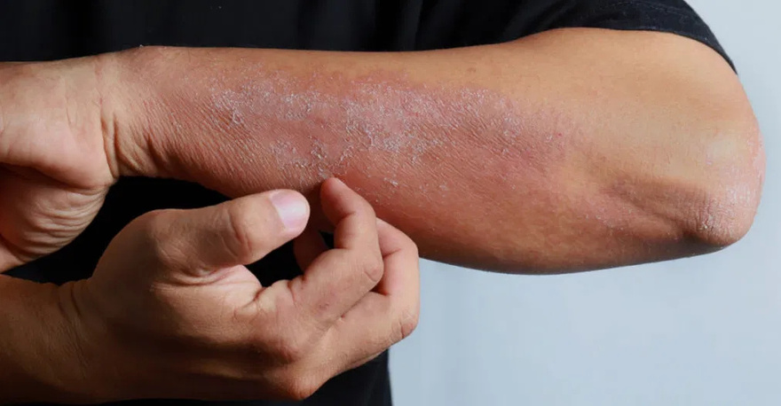 If You See These Painful Red Bumps, Here’s What It Really Means