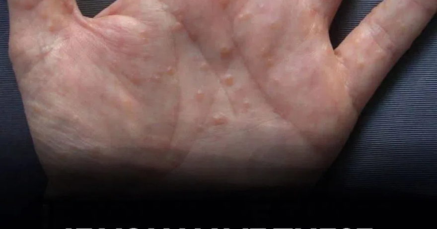 If You See These Painful Red Bumps, Here’s What It Really Means