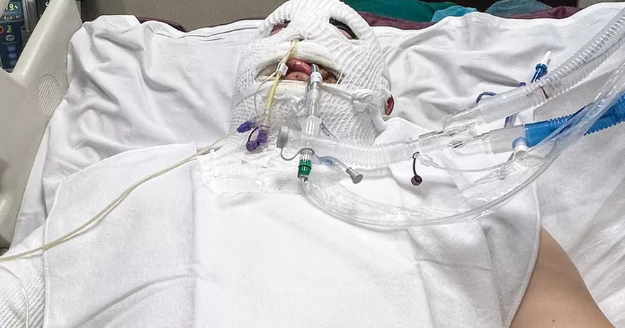 Idaho Man Suffers Third-Degree Burns and Is in a Coma After Freak Accident: ‘I’m Dying! Please Help Me’