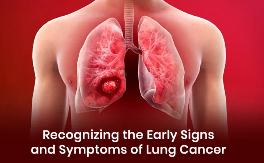 If you have a persistent cough, accompanied by the following 8 symptoms