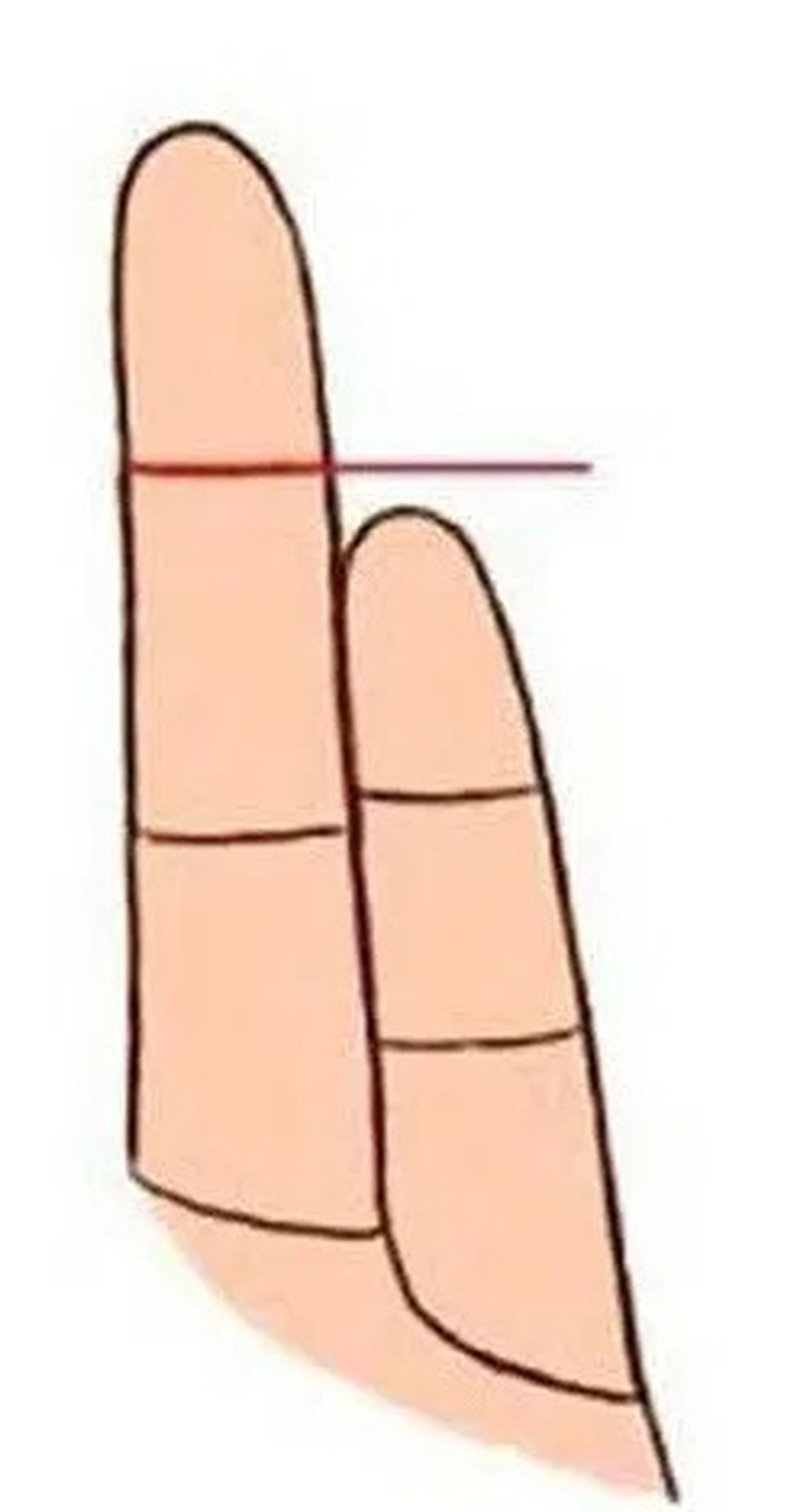 People who have PINKY FINGER like this are very special