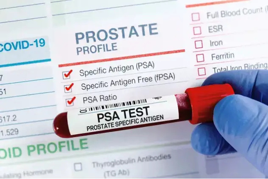 Risk of prostate cancer increases by 45% in men due to a common practice