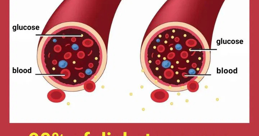 90% of diabetes cases would be reversed if you stopped eating these foods