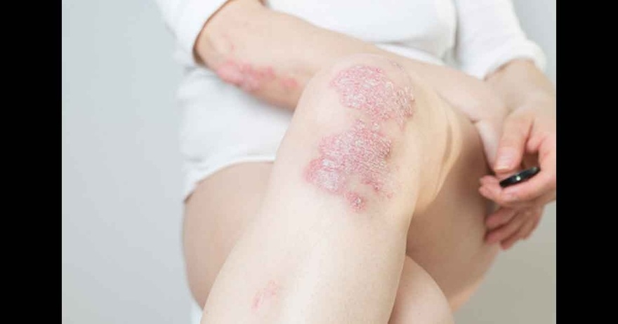 11 Reasons Why You Have Red Dots On Your Skin