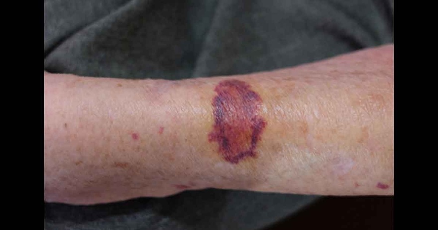 11 Reasons Why You Have Red Dots On Your Skin