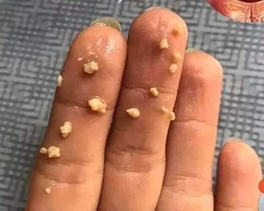 This appears in your mouth, you should be very careful: it can be a war.ning sign