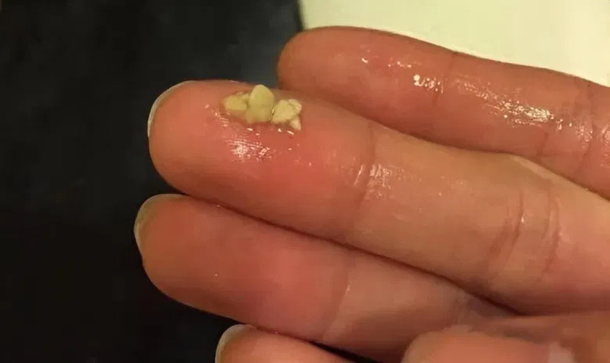 This appears in your mouth, you should be very careful: it can be a war.ning sign