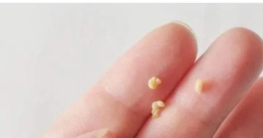 This appears in your mouth, you should be very careful: it can be a war.ning sign