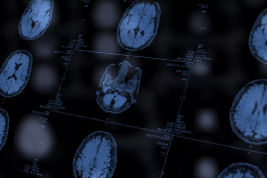 Mom Says 15-Year-Old Son’s Brain Tumor Grew like a ‘Cobweb,’ Terminal Diagnosis Is ‘Shattering’