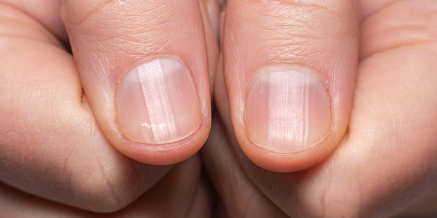 What does the half moon at the base of the nails mean?