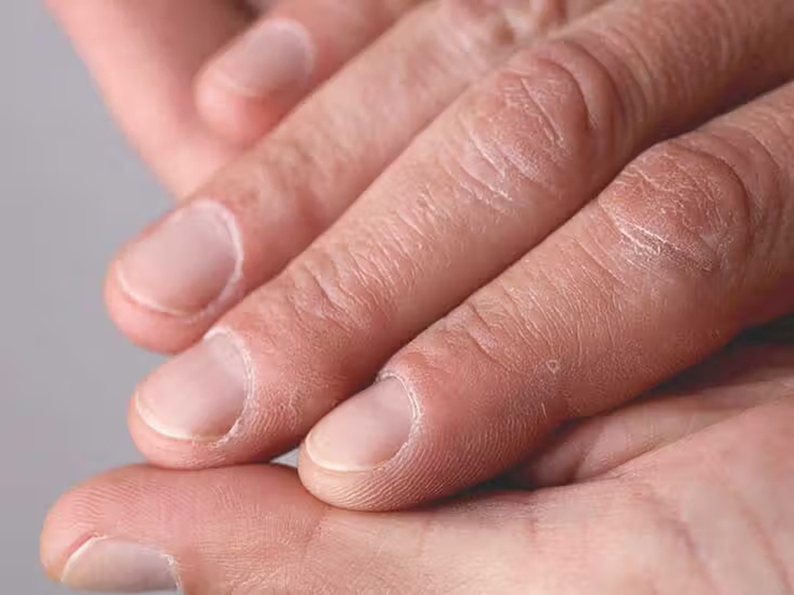What does the half moon at the base of the nails mean?