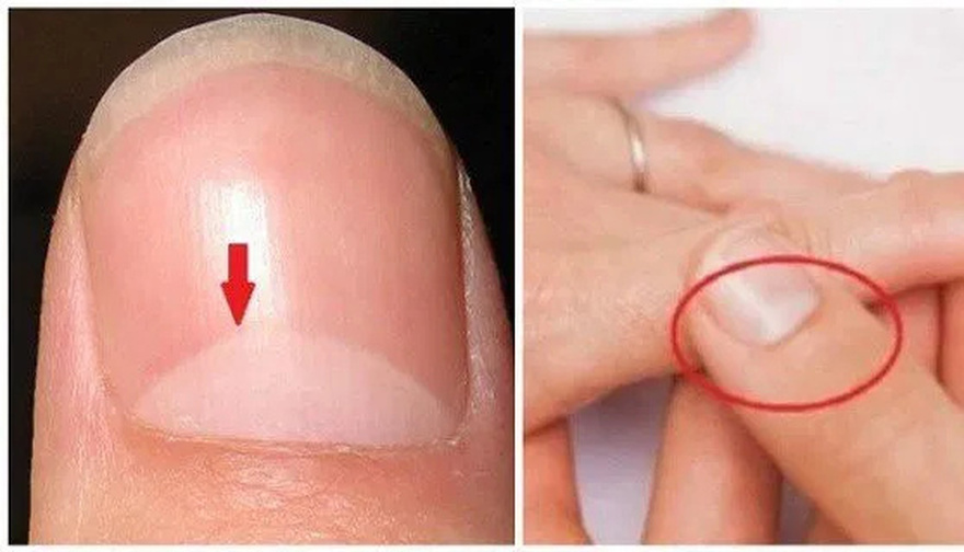 What does the half moon at the base of the nails mean?