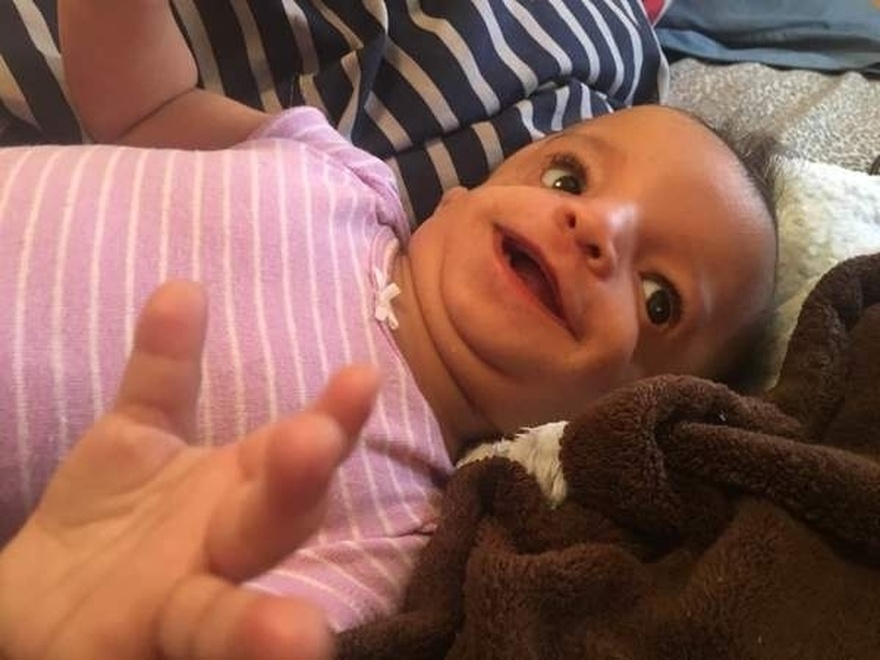 Adoptive family won’t newborn with rare condition