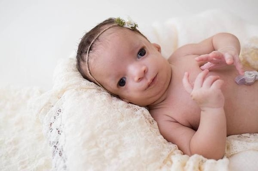 Adoptive family won’t newborn with rare condition