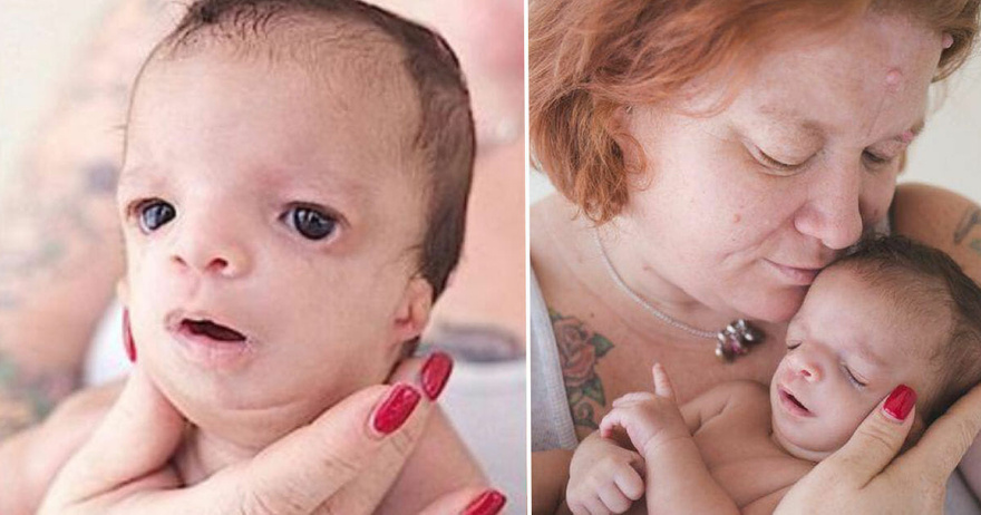 Adoptive family won’t newborn with rare condition