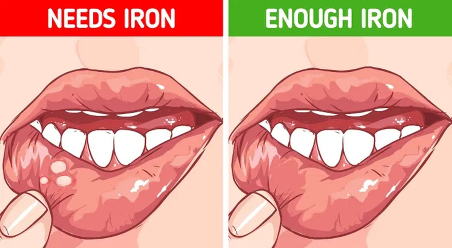 7 Red Flags That Show Your Body Lacks Essential Nutrients