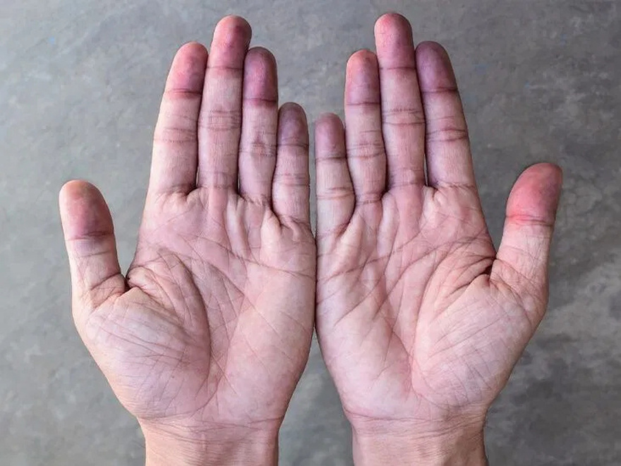 5 Signs Your Heart Is in Serious Dan.ger