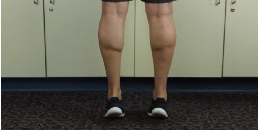 7 Exercises to Help Prevent Spider and Varicose Veins