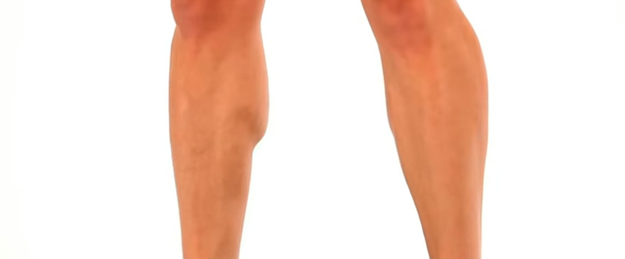 7 Exercises to Help Prevent Spider and Varicose Veins