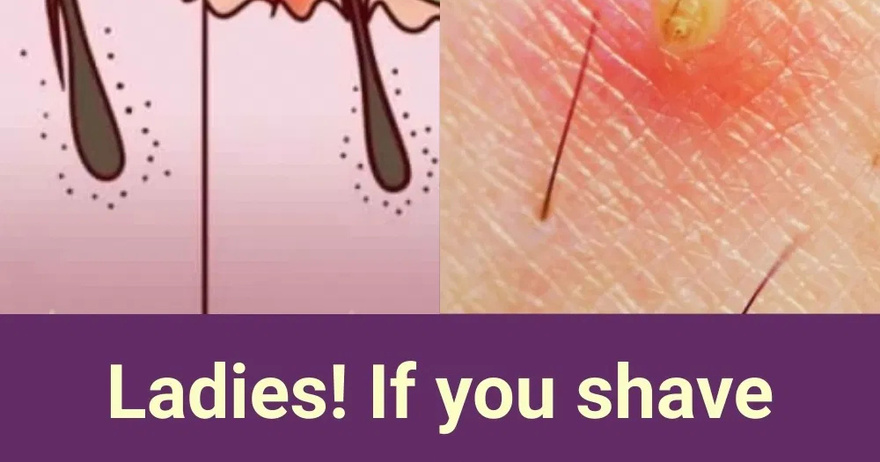 Ladies! If you shave your public hair, read this!