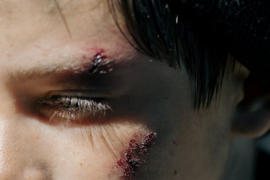 5 Subtle Skin Changes That Could Signal Cancer