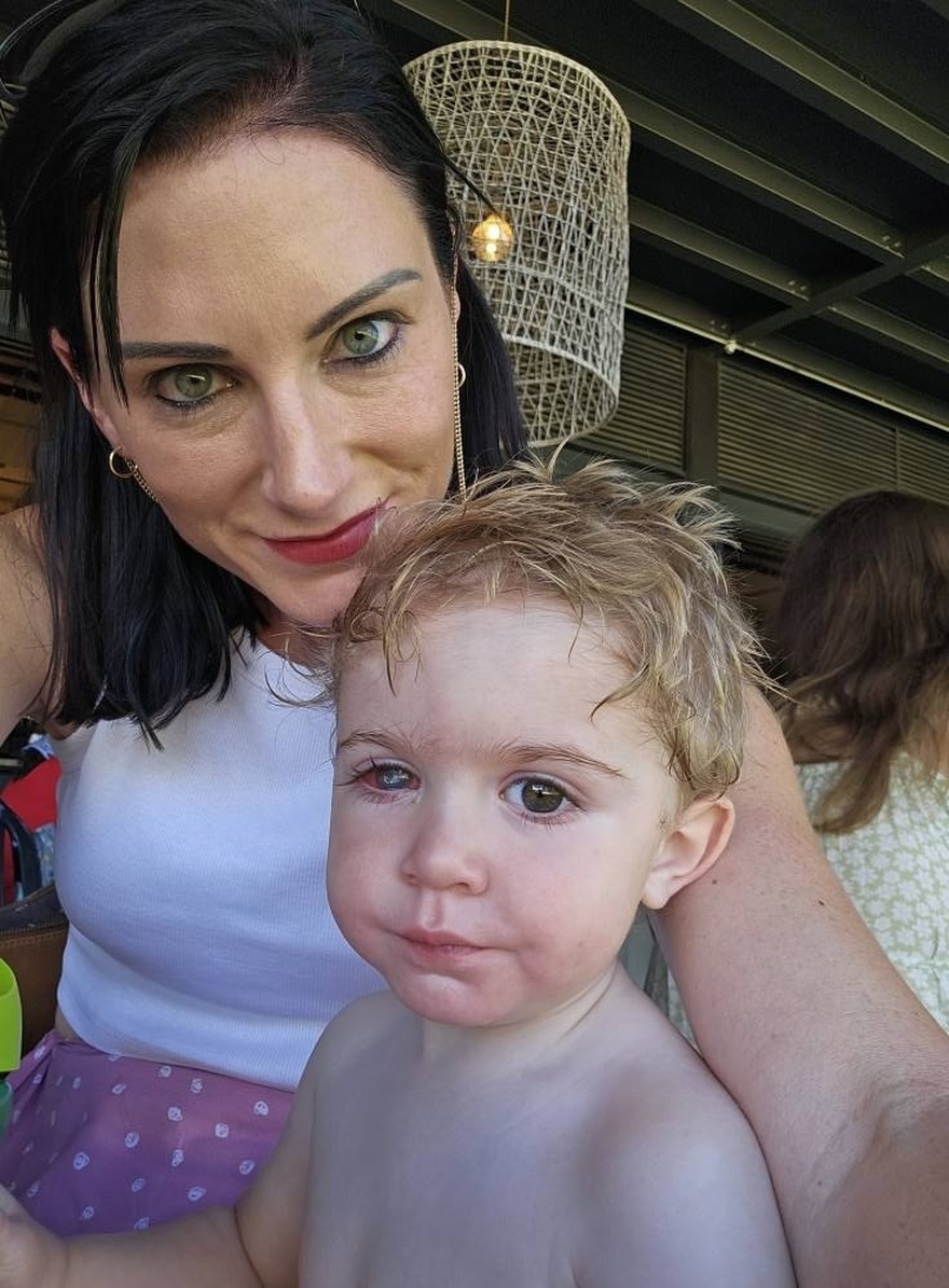 Toddler’s eye ”melts away” after wrong person kissed him