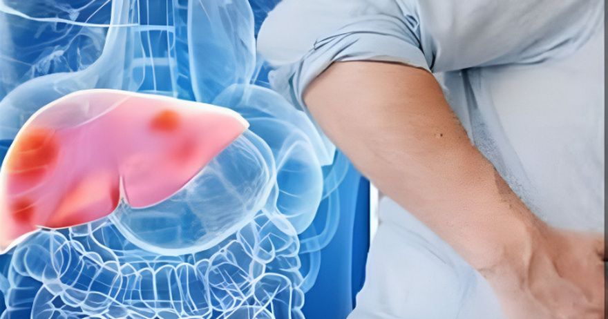 5 Common Food and Drinks That Can Be Just as Bad for Your Liver as Alcohol