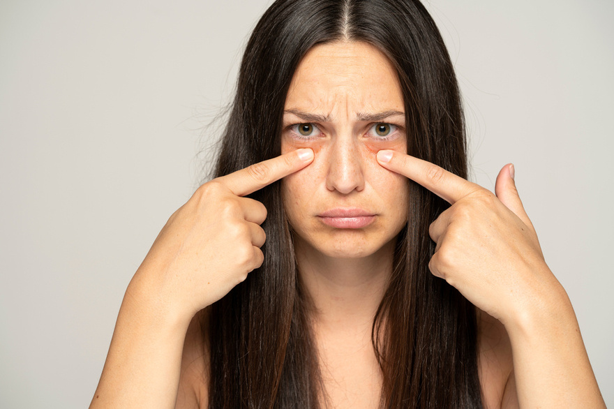 If You Have Dark Eye Circles, Your Body May Be Trying to Warn You